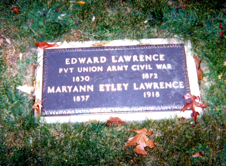 His left hand shows the dangers of his trade